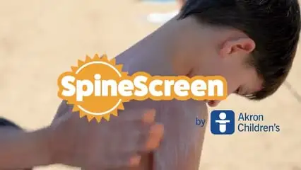 SpineScreen by Akron Children's image