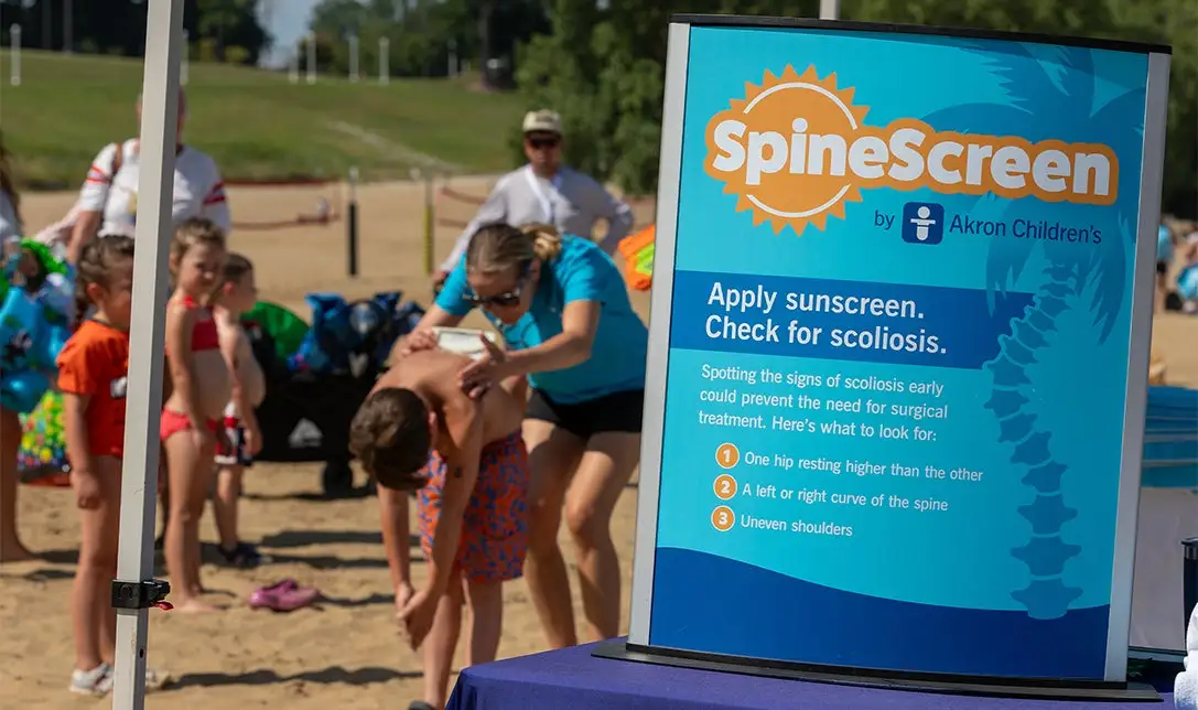 SpineScreen by Akron Children's image
